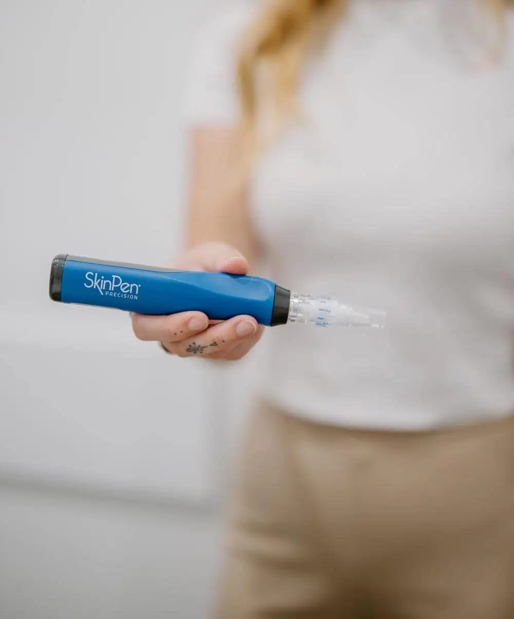 Microneedling device held by a therapist