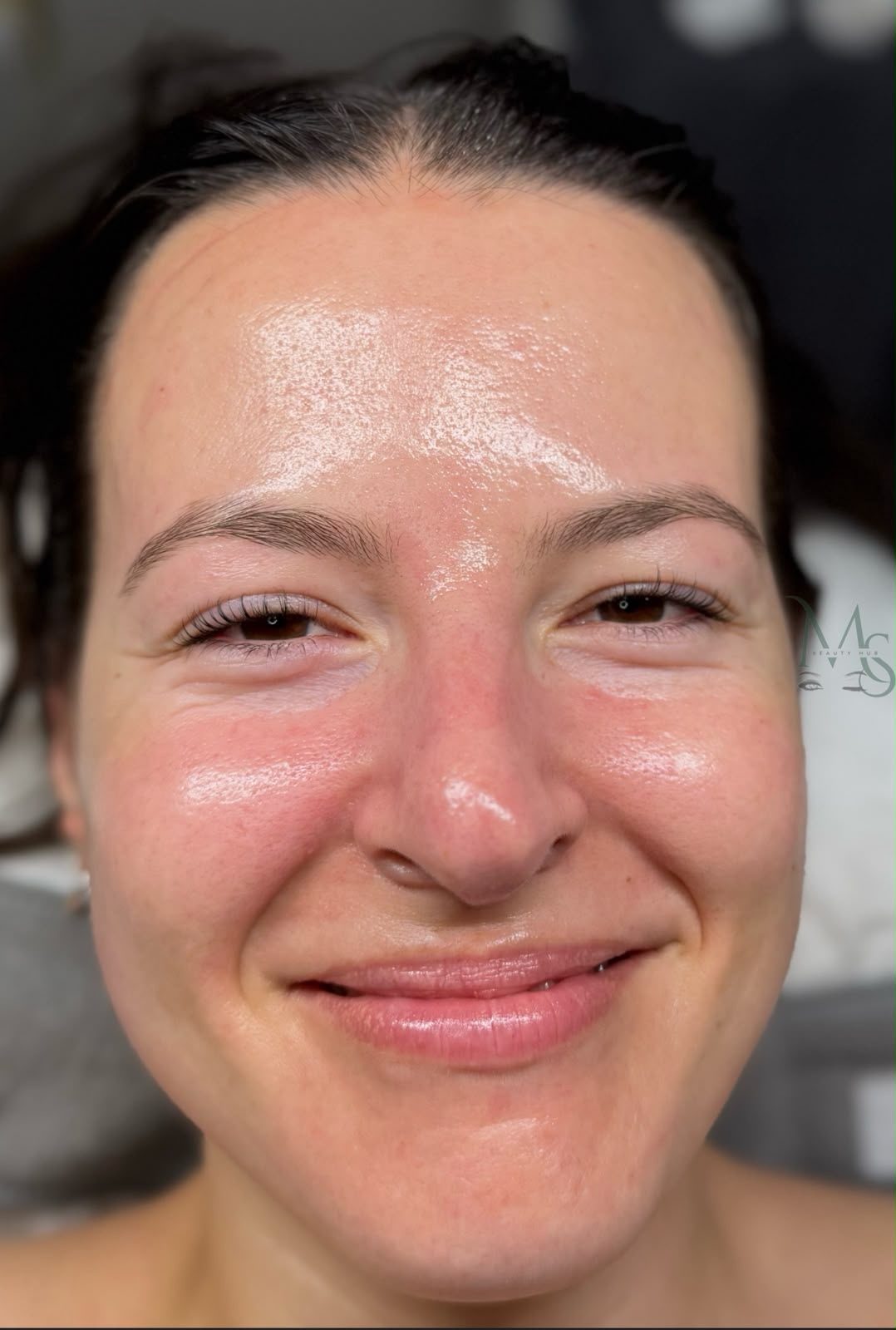 A client's skin glowing after a bespoke facial treatment plan