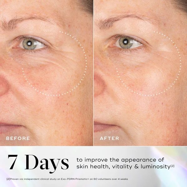 Before and after showing improved skin tone, from Medik8 clinical imagery