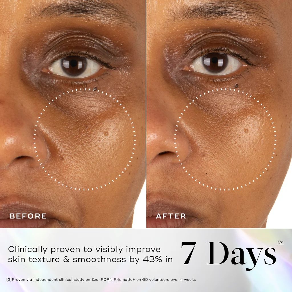 Before and after showing improved skin texture, from Medik8 clinical imagery