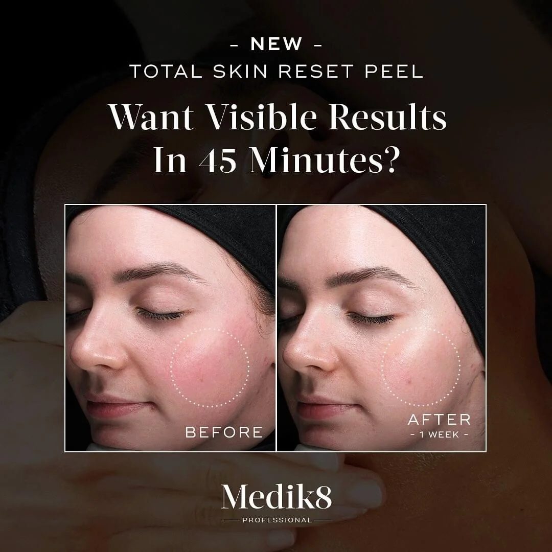 Medik8 Total Skin Reset Peel before and after, one week